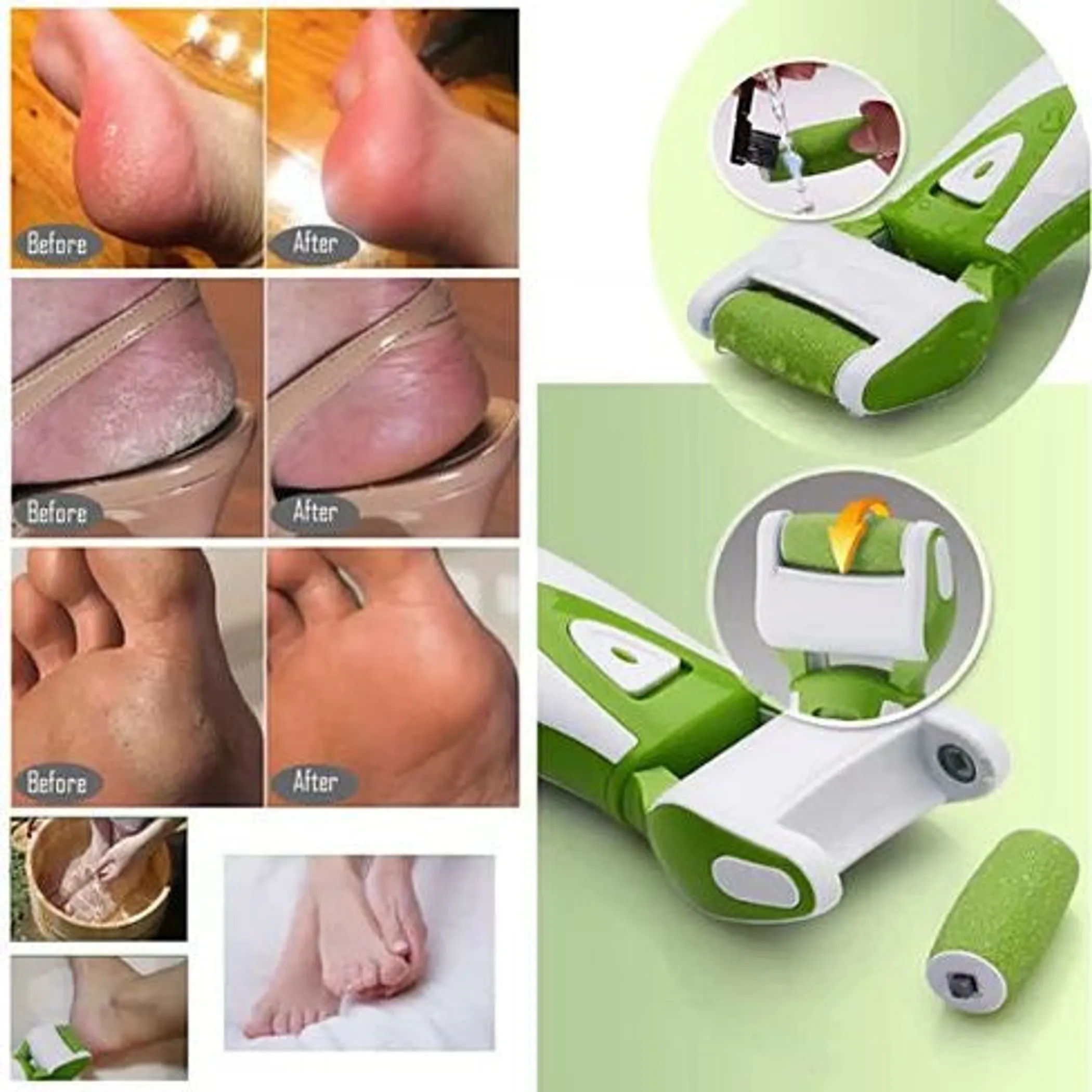 Electric Foot Callus Remover Roller - Image 3